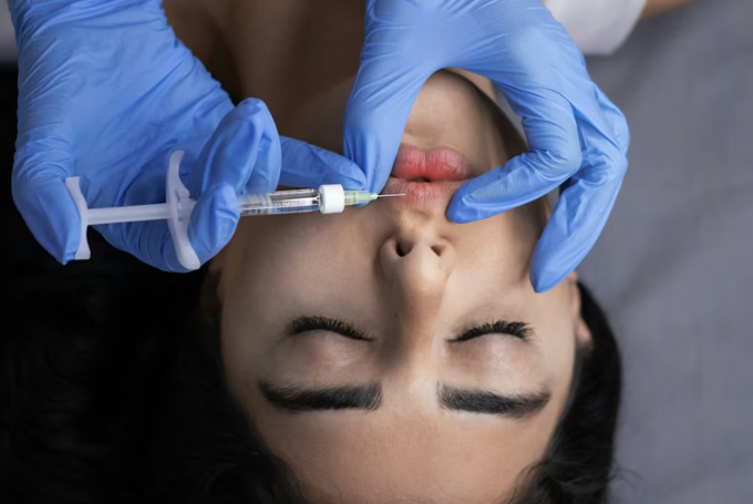 Recovery and Aftercare for Botox in London